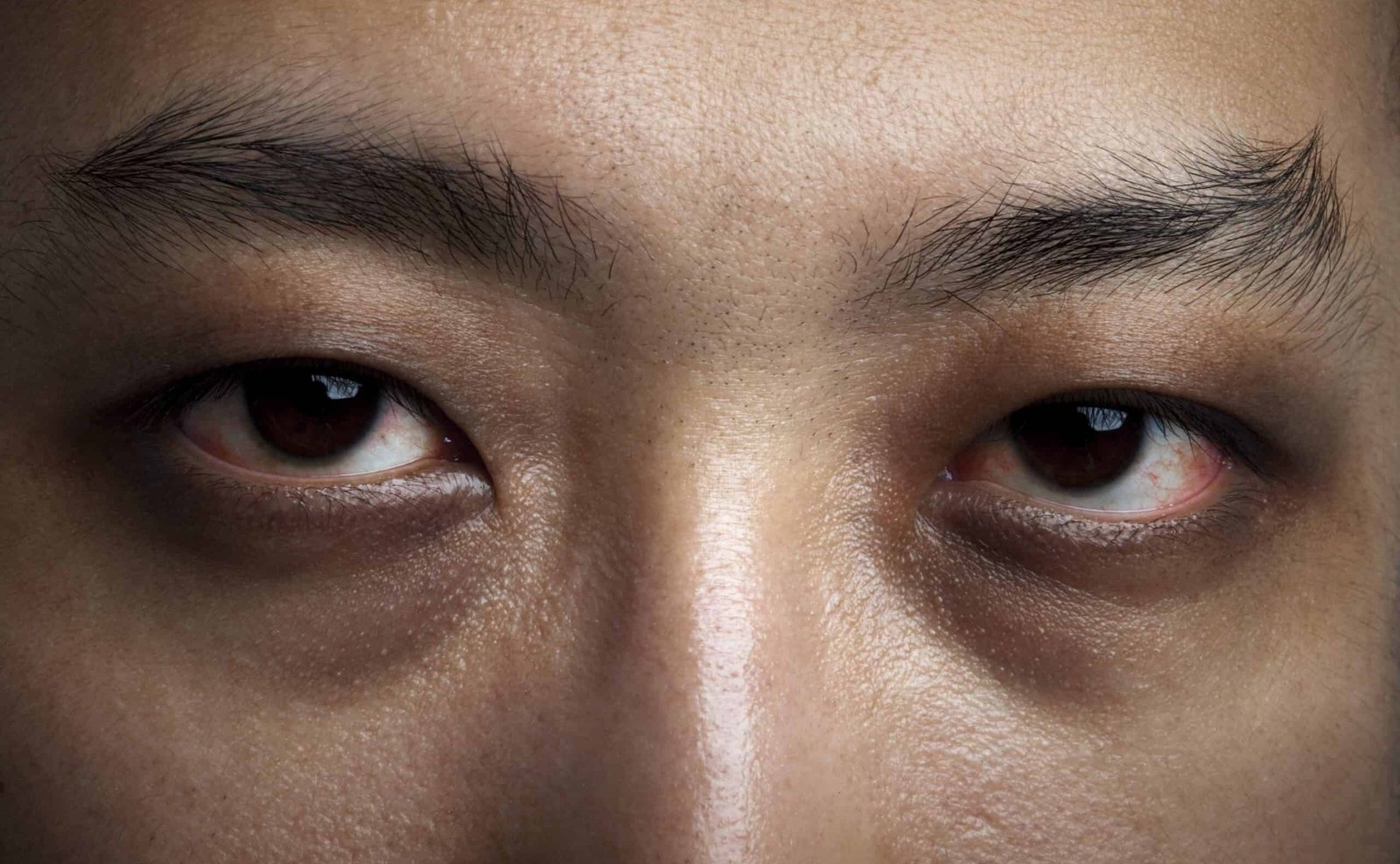 Tired eyes