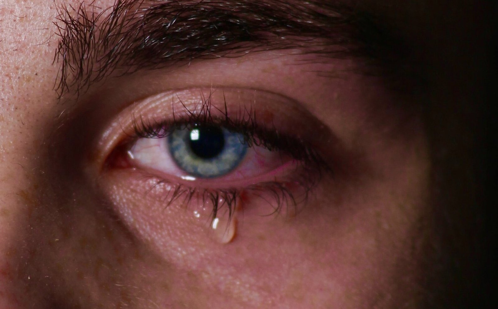 Watery eyes